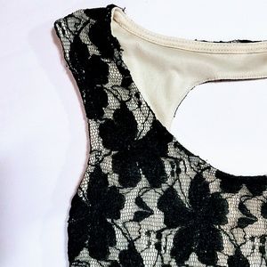 Skater Lace Dress w/ Back Cutout